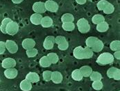 Bactocell: the first probiotic authorized for use in aquaculture in the European Union