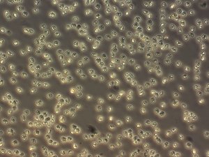 Phaeocystis - 3 -NordsjÃ¸en apr 2015